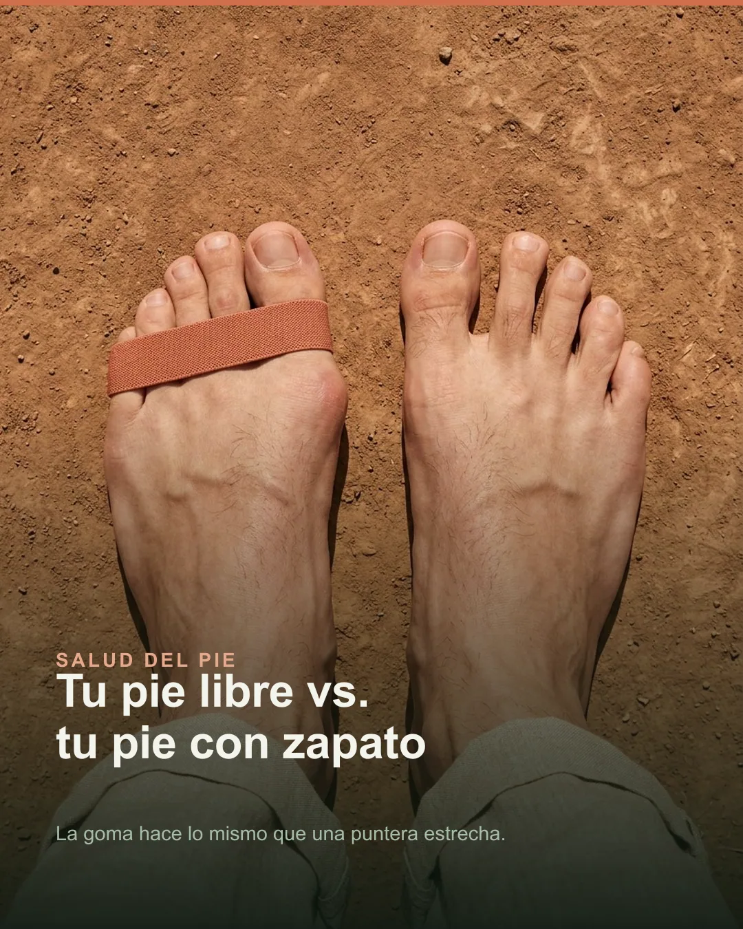 Comparativa de un pie con los dedos apretados por una goma frente al otro pie con los dedos abiertos en abanico.